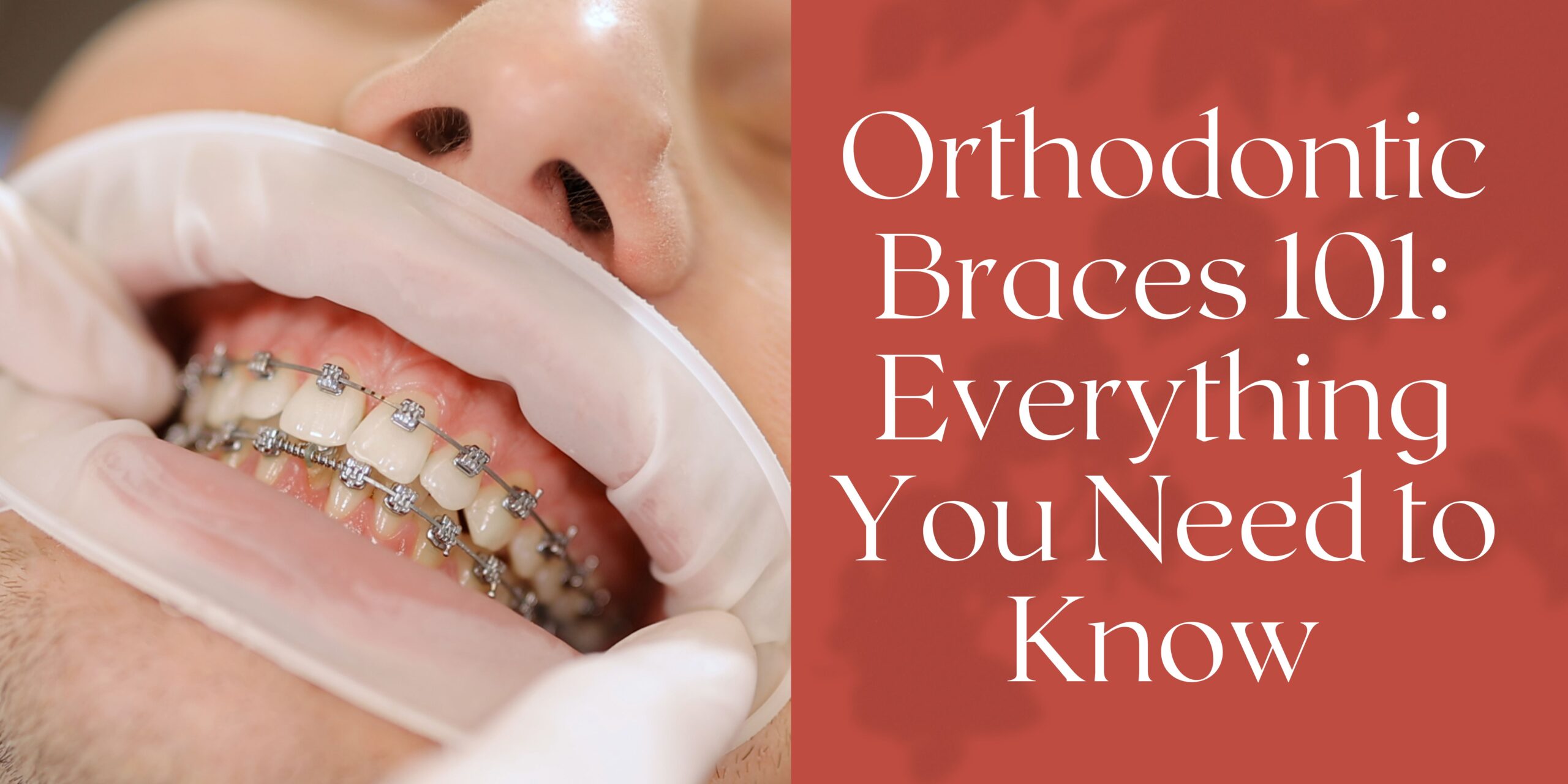 Orthodontic 101